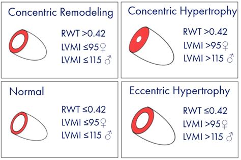 lv calculator|lv wall thickness calculator.